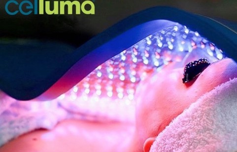 Celluma Light Therapy